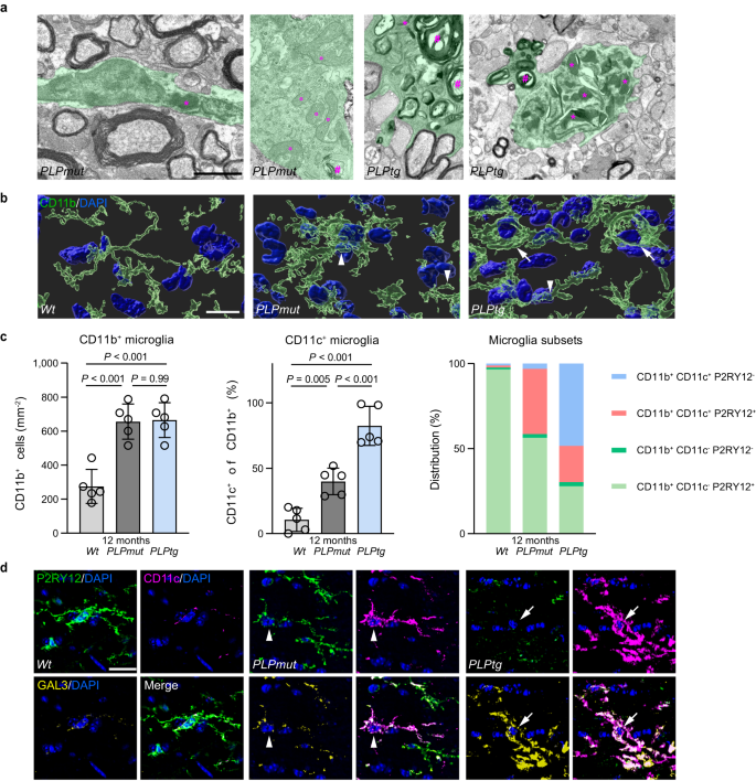 Fig. 4: Myelin phagocytosis by activated microglia mediates demyelination in mice with distinct PLP defects.