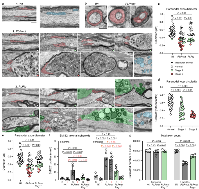 Fig. 6: T cell-driven axonal spheroid formation is initiated in proximity to constricted paranodal domains.