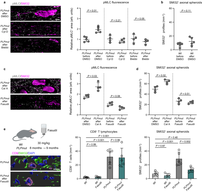 Fig. 9: Actomyosin constriction drives axonal spheroid formation in myelin mutant mice.