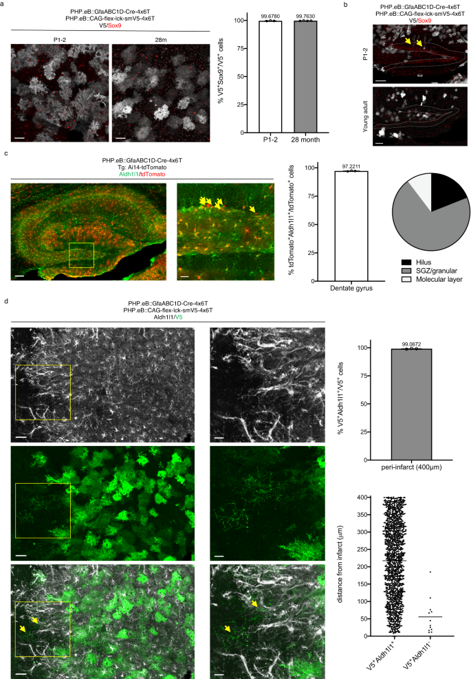 Fig. 3: 4x6T cassette confers astrocyte specificity across the lifespan and in reactive astrocytes.
