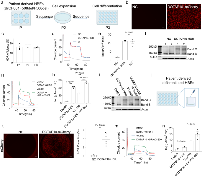 Fig. 5: DOTAP LNPs successfully corrected CFTR mutation and restored CFTR function in patient-derived human bronchial epithelial (HBE) cells with F508del mutation.