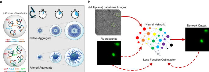 AIが神経変性疾患研究に新たな知見をもたらす(AI unlocks new insights in neurodegenerative disease research)
