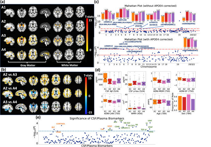Fig. 3: Gene-SGAN identifies four subtypes of brain changes related to AD (A1, A2, A3, and A4).