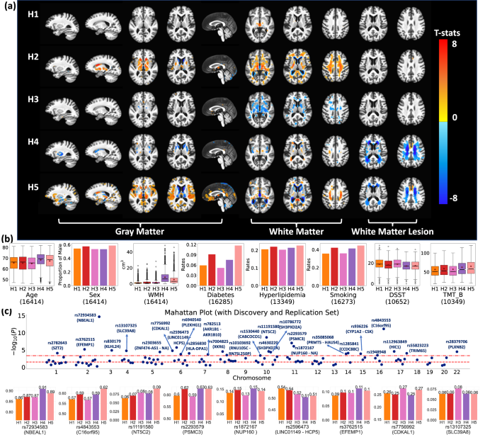 Fig. 4: Gene-SGAN identifies five subtypes of brain changes related to hypertension (H1-H5).