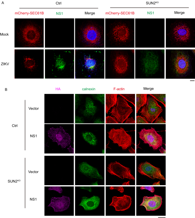 Fig. 6: Role of NS1 in the ER and cytoskeleton remodeling induced by ZIKV.