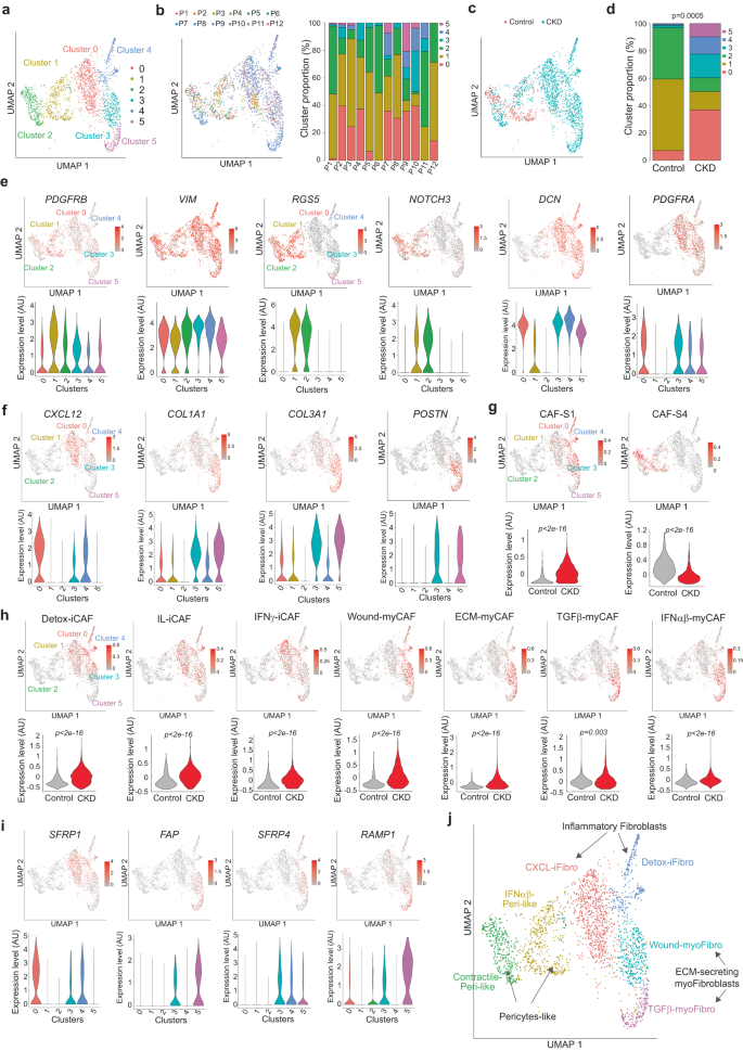 Fig. 1: Identification of distinct mesenchymal clusters in CKD.