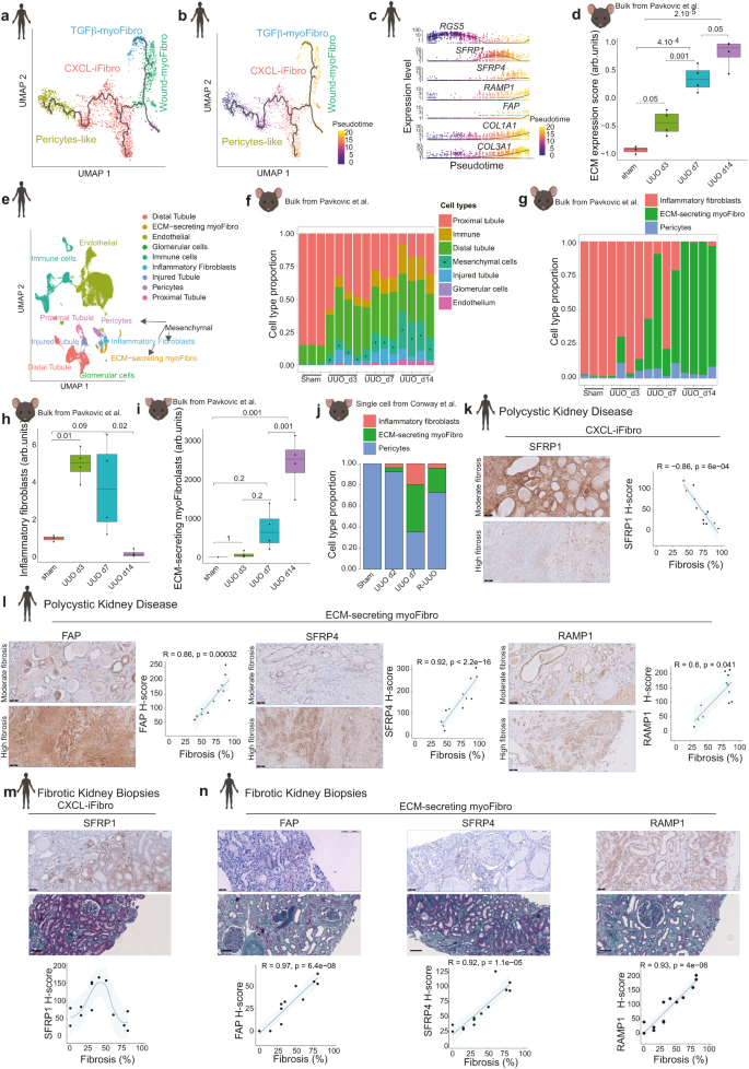 Fig. 2: Accumulation of CXCL-iFibro and ECM-myFibro clusters at distinct stages of chronic kidney disease.
