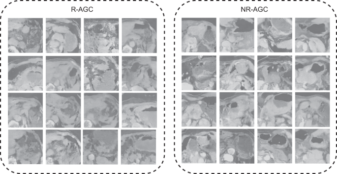 Fig. 5: A representative dataset was generated based on the WGAN.