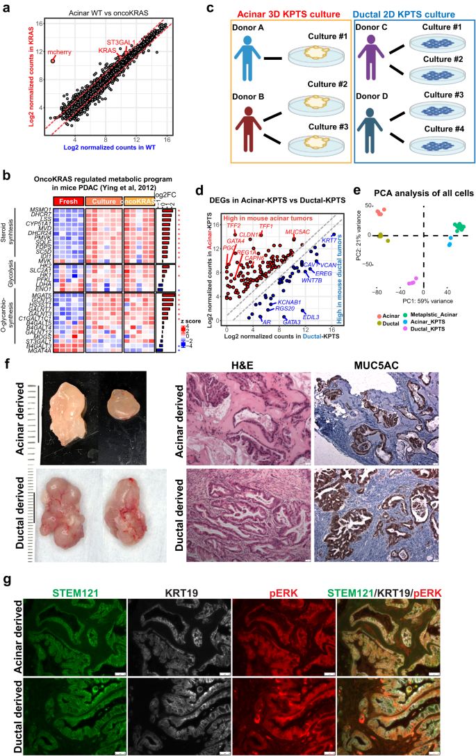 Fig. 3: Genetically engineering human primary acinar and ductal cells to form PDAC.