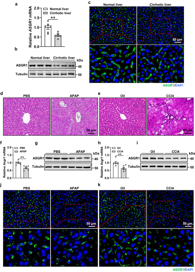 Fig. 1: Hepatic ASGR1 is downregulated in cirrhotic patients and liver injured mice.