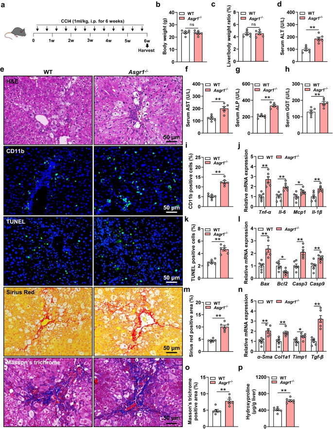 Fig. 2: ASGR1 deficiency exacerbates CCl4-induced chronic liver injury.