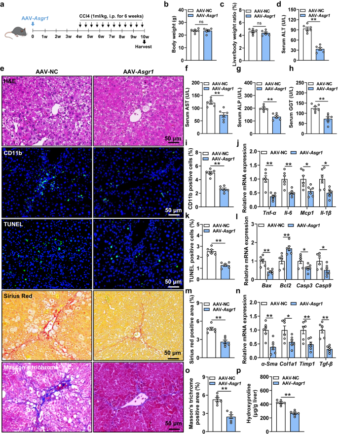 Fig. 3: Hepatic overexpression of Asgr1 ameliorates CCl4-induced chronic liver injury.