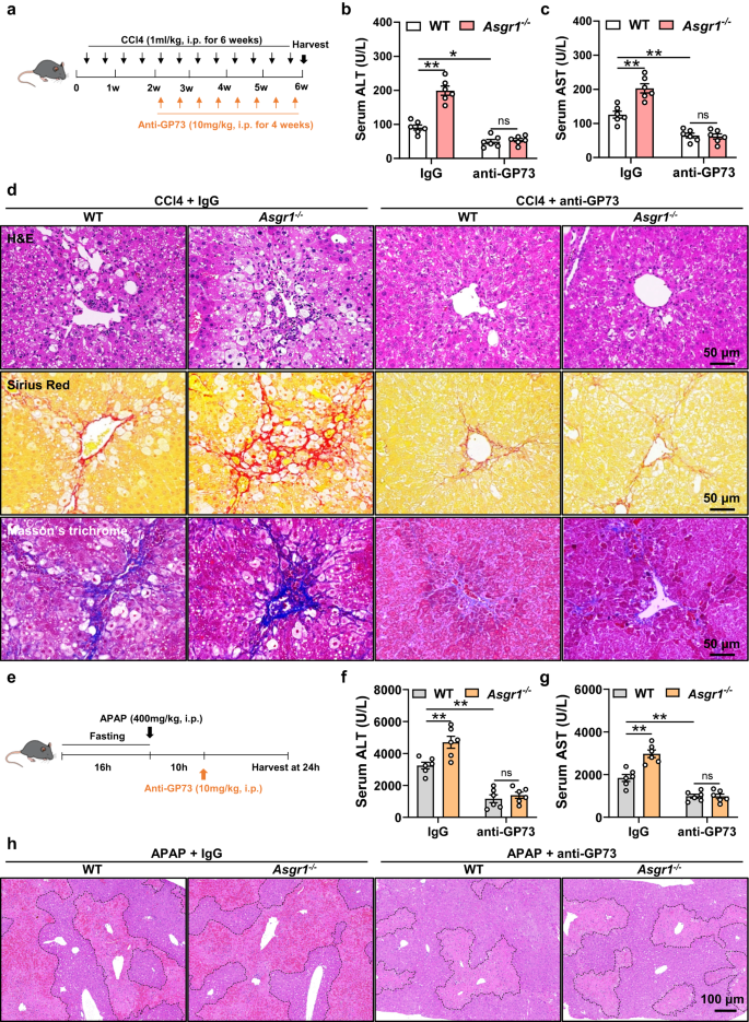 Fig. 7: Neutralization of GP73 attenuates ASGR1 deficiency-induced liver injury.