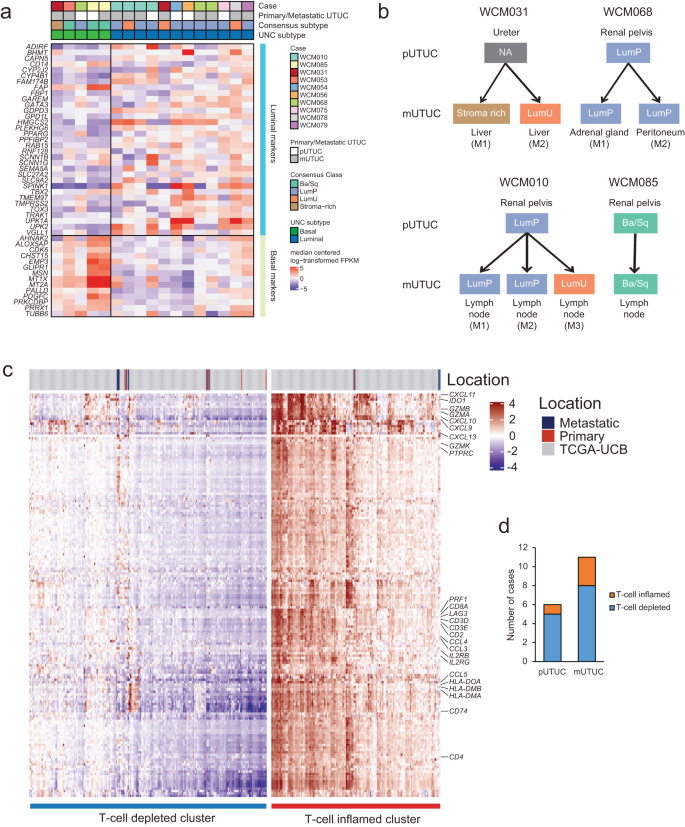 Fig. 4: Comparison of molecular subtype and T-cell inflammation classification in primary and metastatic UTUC.