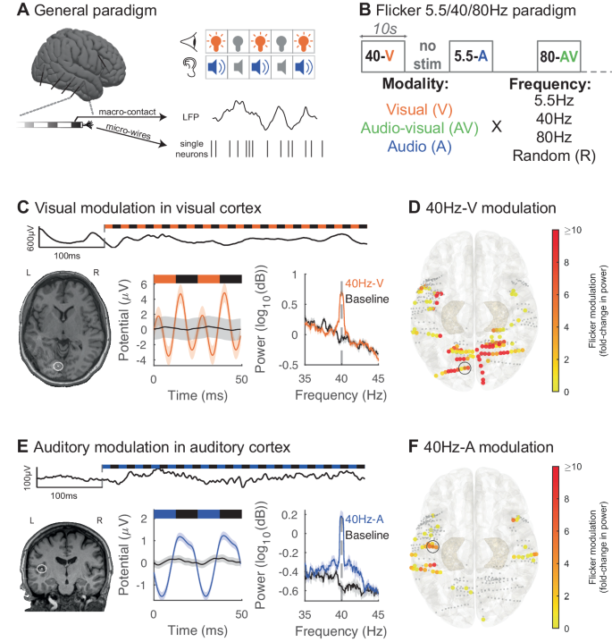 てんかんの臨床試験でフリッカー刺激が注目される(Flicker Stimulation Shines in Clinical Trial for Epilepsy)