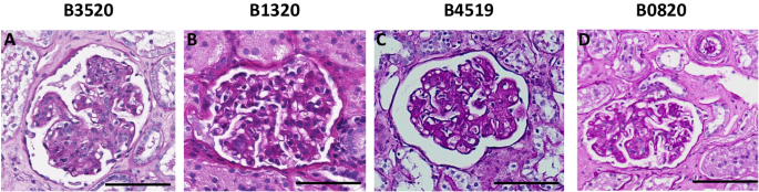 Fig. 2: Four of five xenograft recipients maintained stable graft function beyond six months.
