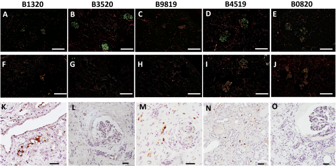Fig. 4: Xenograft loss in remaining animals associated with adenovirus infection in the absence of antibody binding in xenograft.