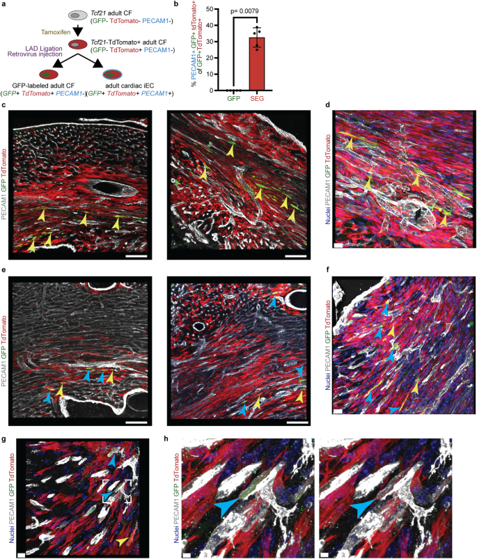 Fig. 7: Sox17-Erg directly reprograms cardiac fibroblasts in vivo.