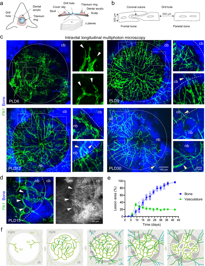 頭蓋骨における骨形成の先駆者は血管である(Blood vessels are the pioneers of bone formation in the skull)