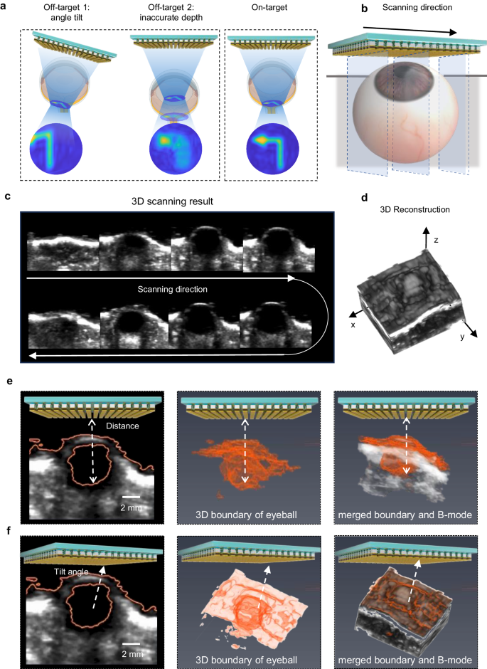 Fig. 2: Precise stimulation of retina using 3D imaging guidance and retina auto-detection.