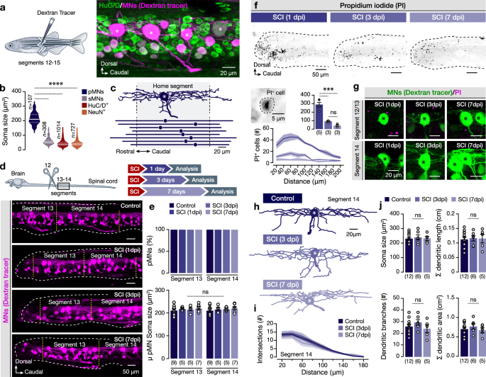 ゼブラフィッシュの研究結果が、将来の脊髄損傷治療に希望を与える(Findings in zebrafish give hope for future treatment of spinal cord injury)