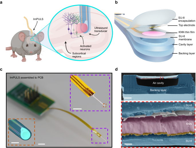 超音波は脳深部刺激を行う新しい方法を提供する(Ultrasound offers a new way to perform deep brain stimulation)