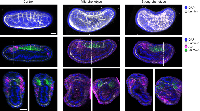 An amphioxus neurula stage cell atlas supports a complex scenario 