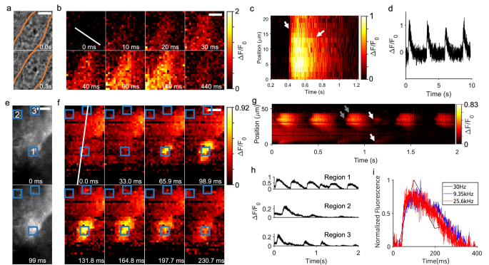 送料無料MABELSTAR SCMOS High-Speed USB2.0 5.0M Digital Microscope Eyepiece Camera Support Windows/Linux/Mac並行輸入 MABELSTAR E3CMOS 2.3M Microscope⁄Telescope Camera Nigeria | Ubuy