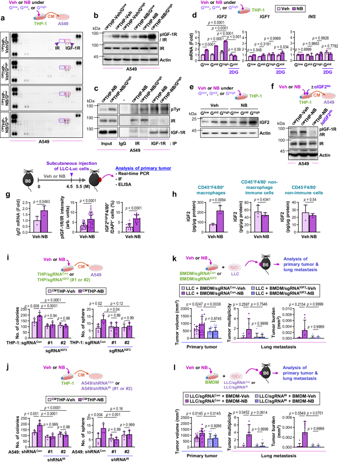 Fig. 5: NB-primed macrophages under glucose-supplemented conditions upregulate IGF2 expression and activate IR in tumor cells in a paracrine manner.