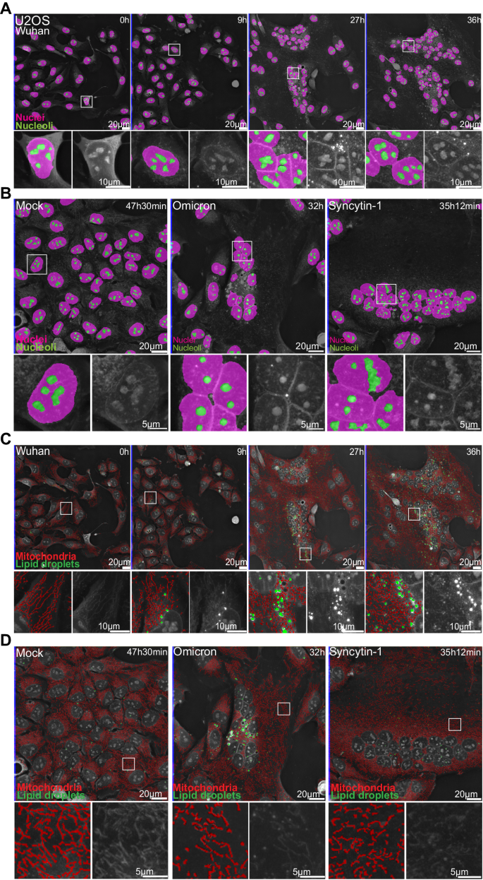 dynamic-label-free-analysis-of-sars-cov-2-infection-reveals-virus-induced-subcellular-remodeling-nature-communications