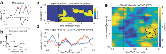 sleep and memory research figure 4
