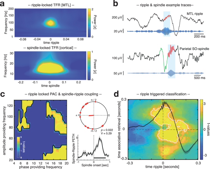 sleep and memory research figure 5