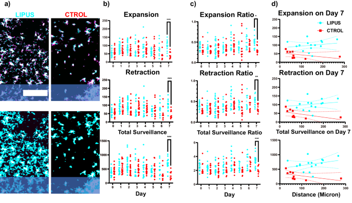 Fig. 4: LIPUS increased the surveillance area expansion/retraction and total surveillance area of microglia on day 7.