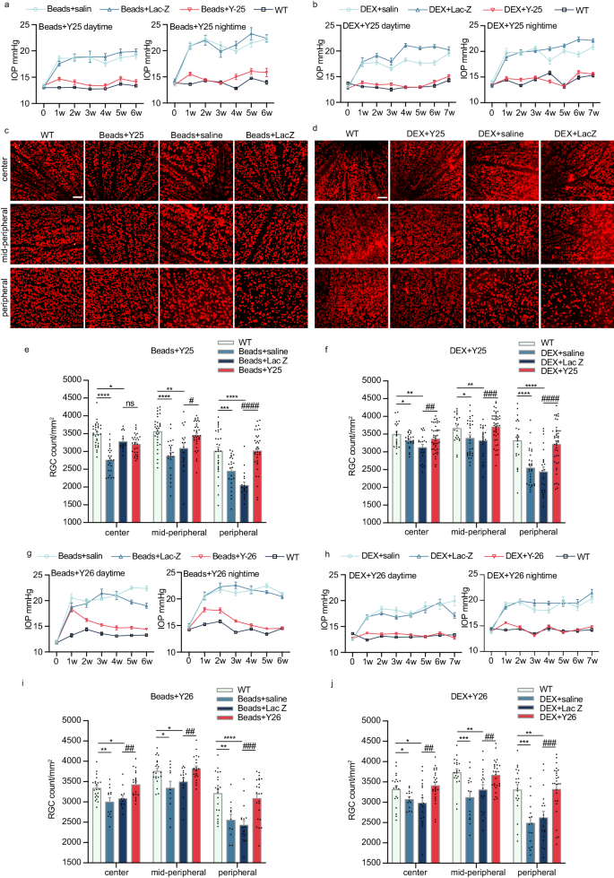 Fig. 4: Gene disruption mediated by CasRx editing system effectively reduced IOP and RGC damage in two types of glaucoma models.