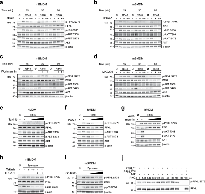 Fig. 2: The IKK complex and PKC function in PFKL Ser775 phosphorylation.