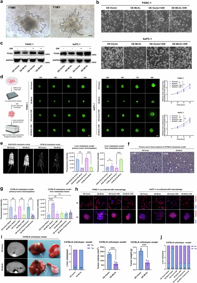 Fig. 3: MLKL-driven necroptosis leads to immune-dependent promotion of PDAC liver metastasis despite suppression of cell proliferation.