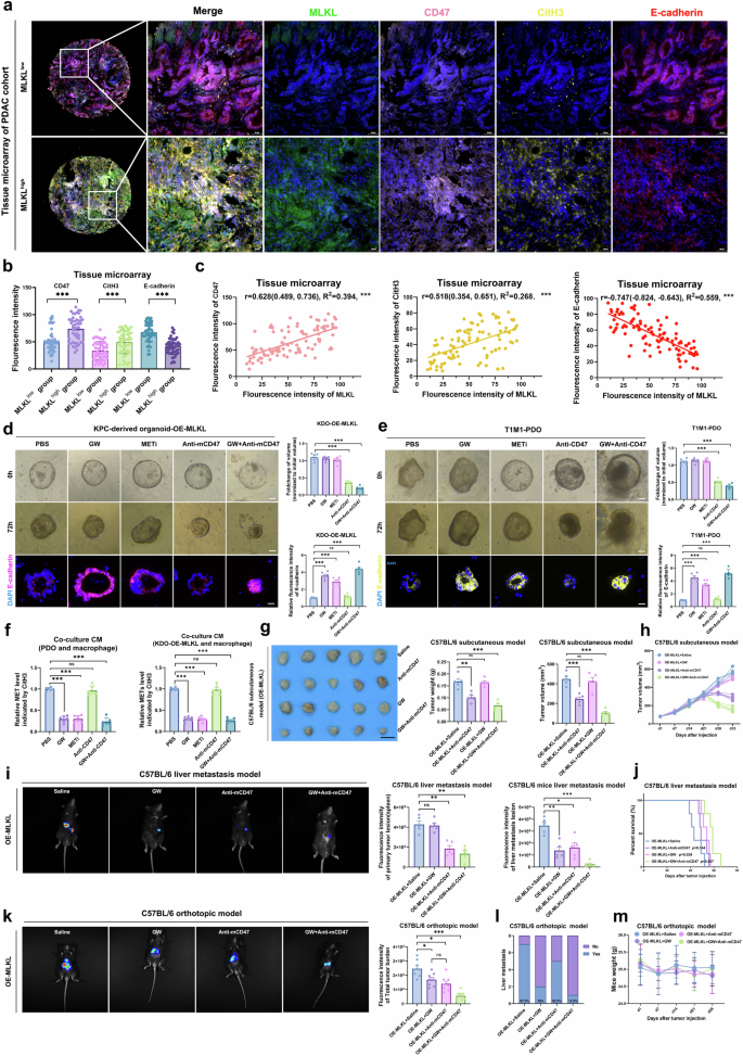 Fig. 9: GW combined with anti-CD47 suppresses the progression and metastasis of T1M1-PDAC.