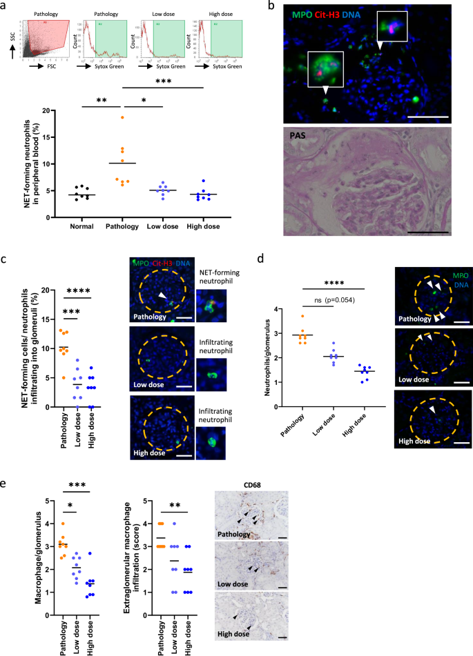 Fig. 6: Suppression of NET formation by MOD06051 in MPO-AAV rats.
