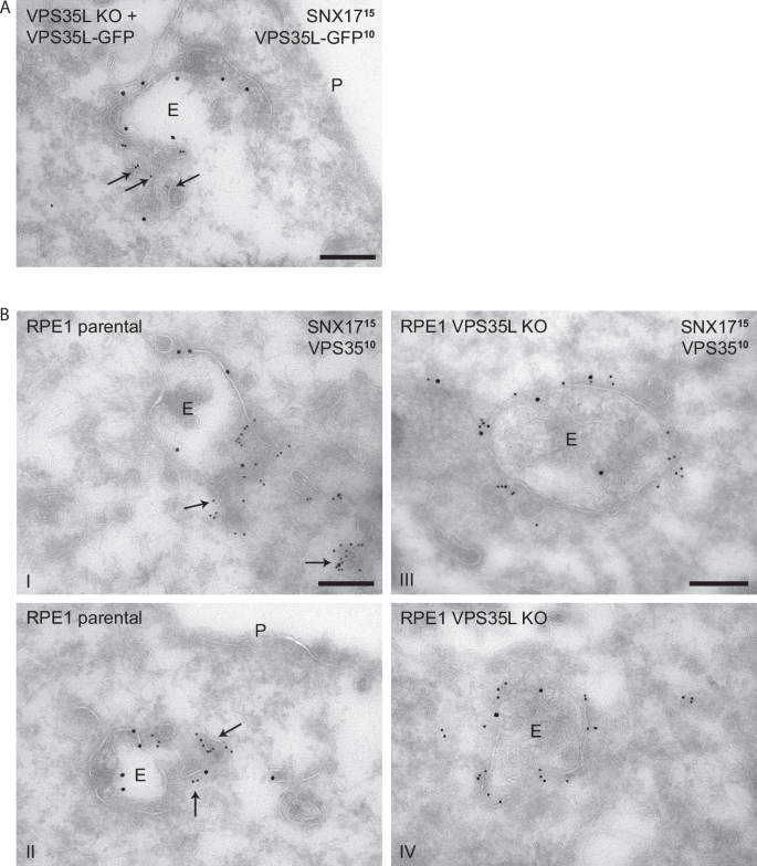 Fig. 7: Retriever depletion perturbs Retromer sub-domain organisation.