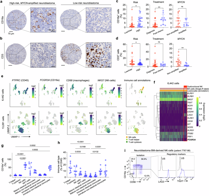 Fig. 2: High-risk neuroblastoma tumors harbor a substantial infiltration of CD16a-expressing innate immune cells.