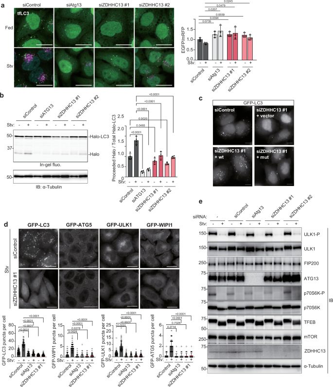 Fig. 1: ZDHHC13 knockdown impaired autophagy at an early step.