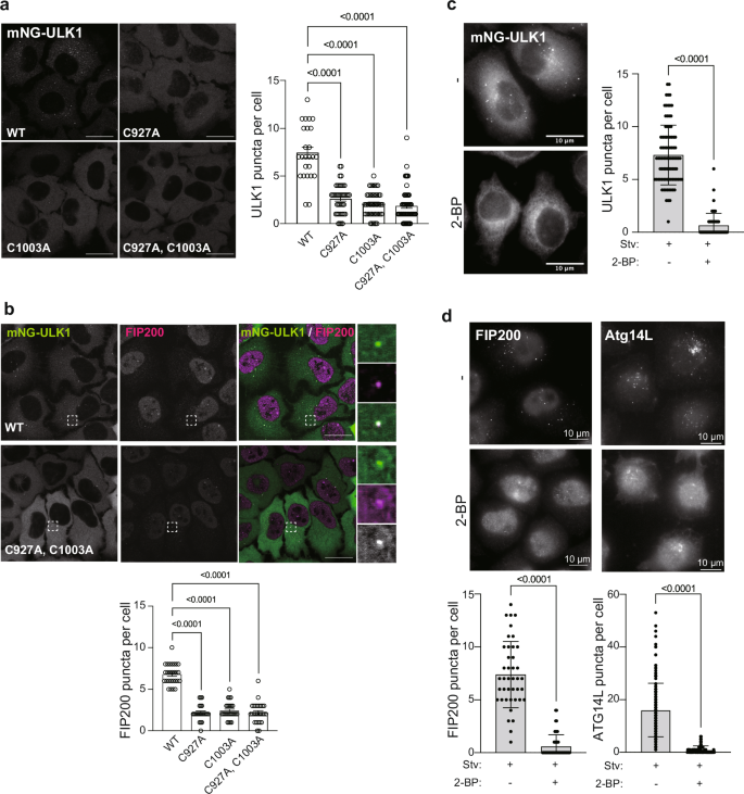 Fig. 3: ULK1 puncta formation depends on the palmitoylation.