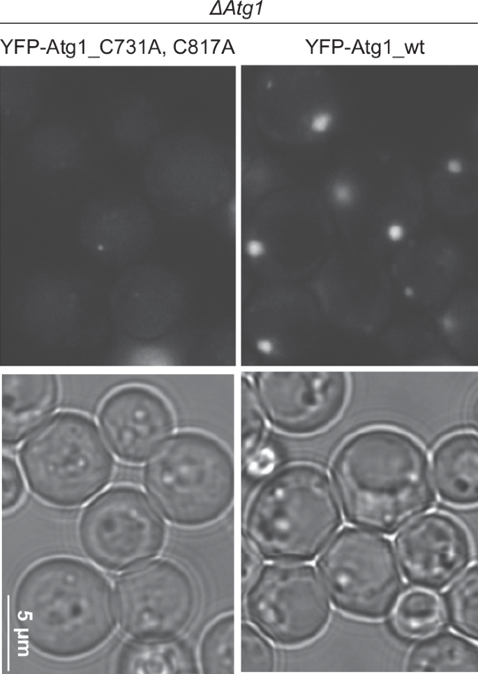 Fig. 4: Palmitoylation sites in yeast are conserved and essential for PAS formation.