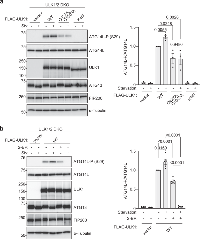 Fig. 5: Palmitoylation of ULK1 promotes the kinase activity against ATG14L.