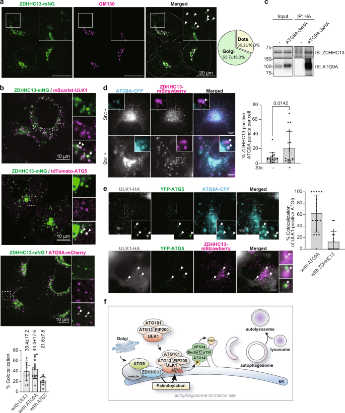 Fig. 7: ZDHHC13 is recruited to the autophagosome formation site.