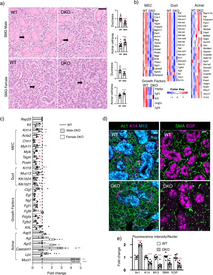 Specific 3-O-sulfated heparan sulfate domains regulate salivary gland basement membrane metabolism and epithelial differentiation | Nature Communications specific-3-o-sulfated-heparan-sulfate-domains-regulate-salivary-gland-basement-membrane-metabolism-and-epithelial-differentiation-nature-communications