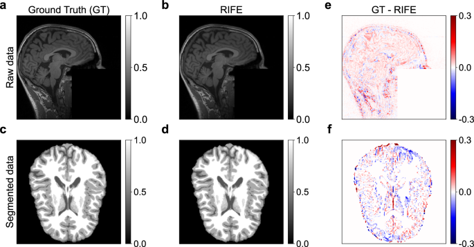 thesis about neural networks figure 7