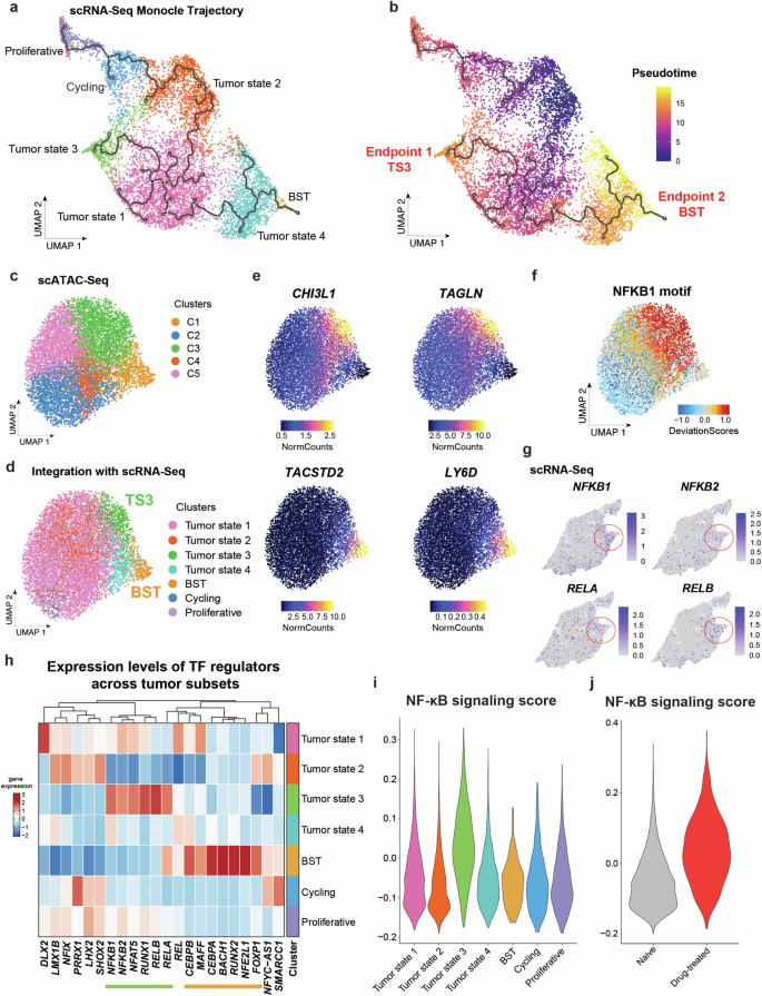 Fig. 2: Tumor epithelial basal to inflammatory transition (BIT) is regulated by inflammatory NF-κB family of transcription factors.
