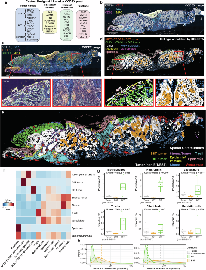 Fig. 3: BIT tumor epithelium is localized in a pro-inflammatory niche enriched with myeloid cells.