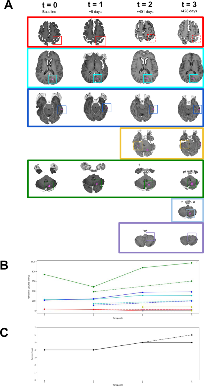Fig. 2: Metastatic brain tumor tracking using the NYUMets API.